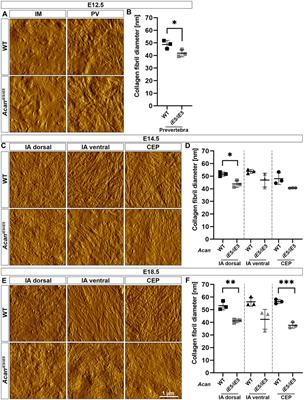 Aggrecan governs intervertebral discs development by providing critical mechanical cues of the extracellular matrix